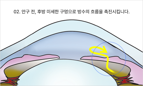 02. 안구 전, 후방 미세한 구멍으로 방수의 흐름을 촉진시킵니다.